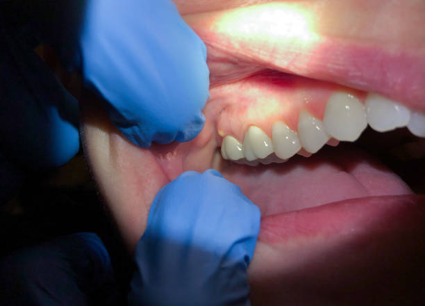 Best Emergency Treatment for Jaw Pain or Injury in Springfield, TN